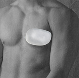 Implantati za pektoralni dio