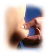 Liposukcija