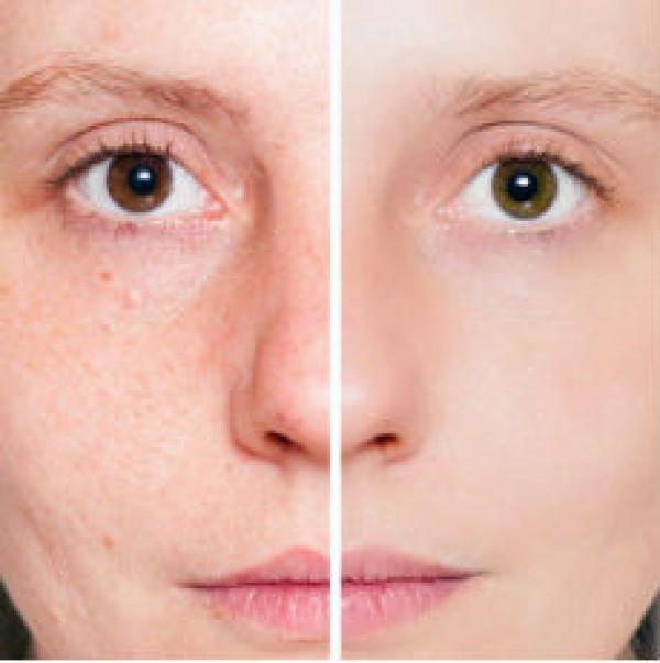 Out of the Dark – Reversing Sun Spots