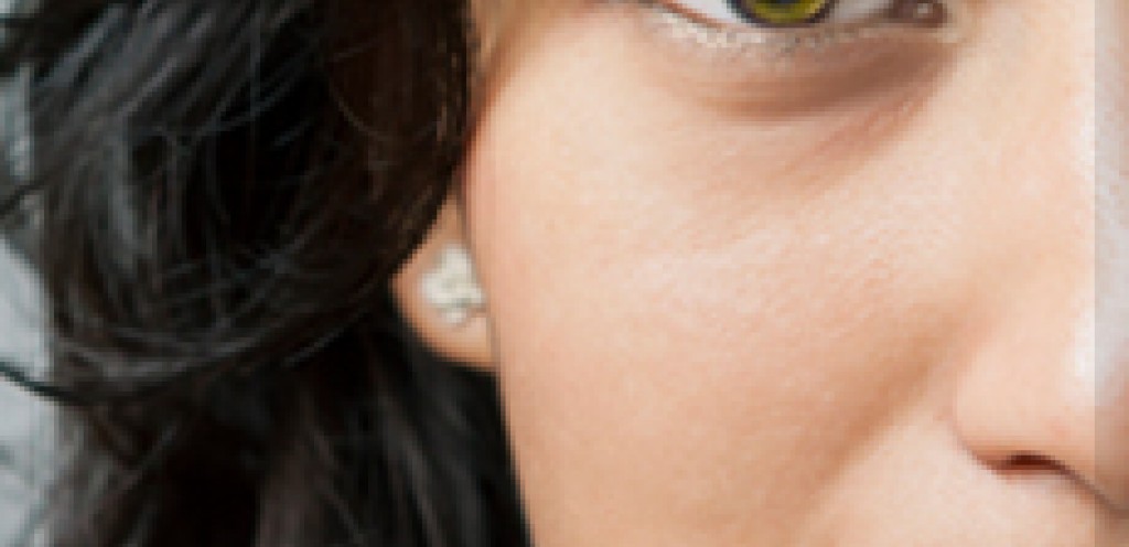 Get Smart About Fillers