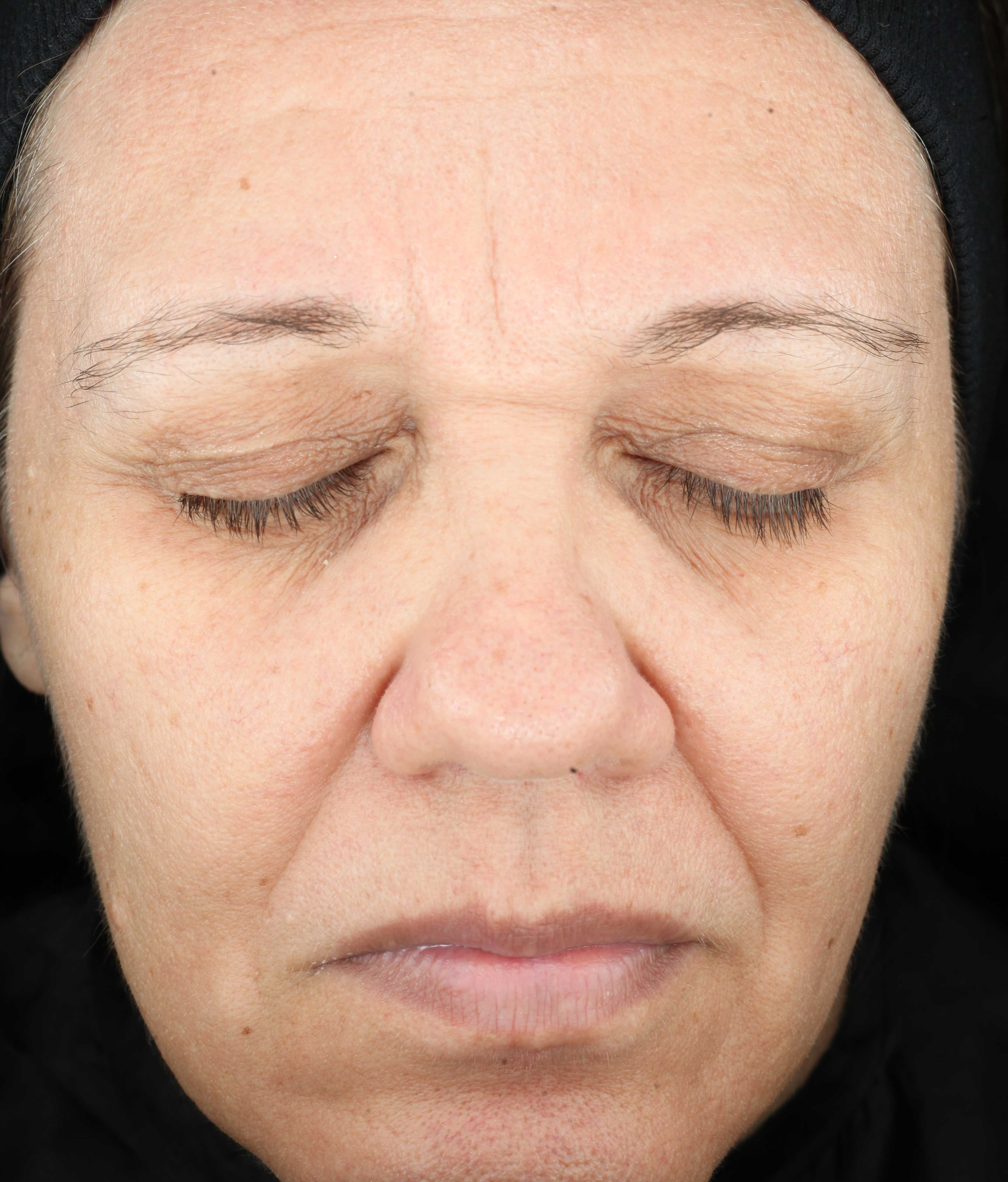 Poslije Growth Factor Serum