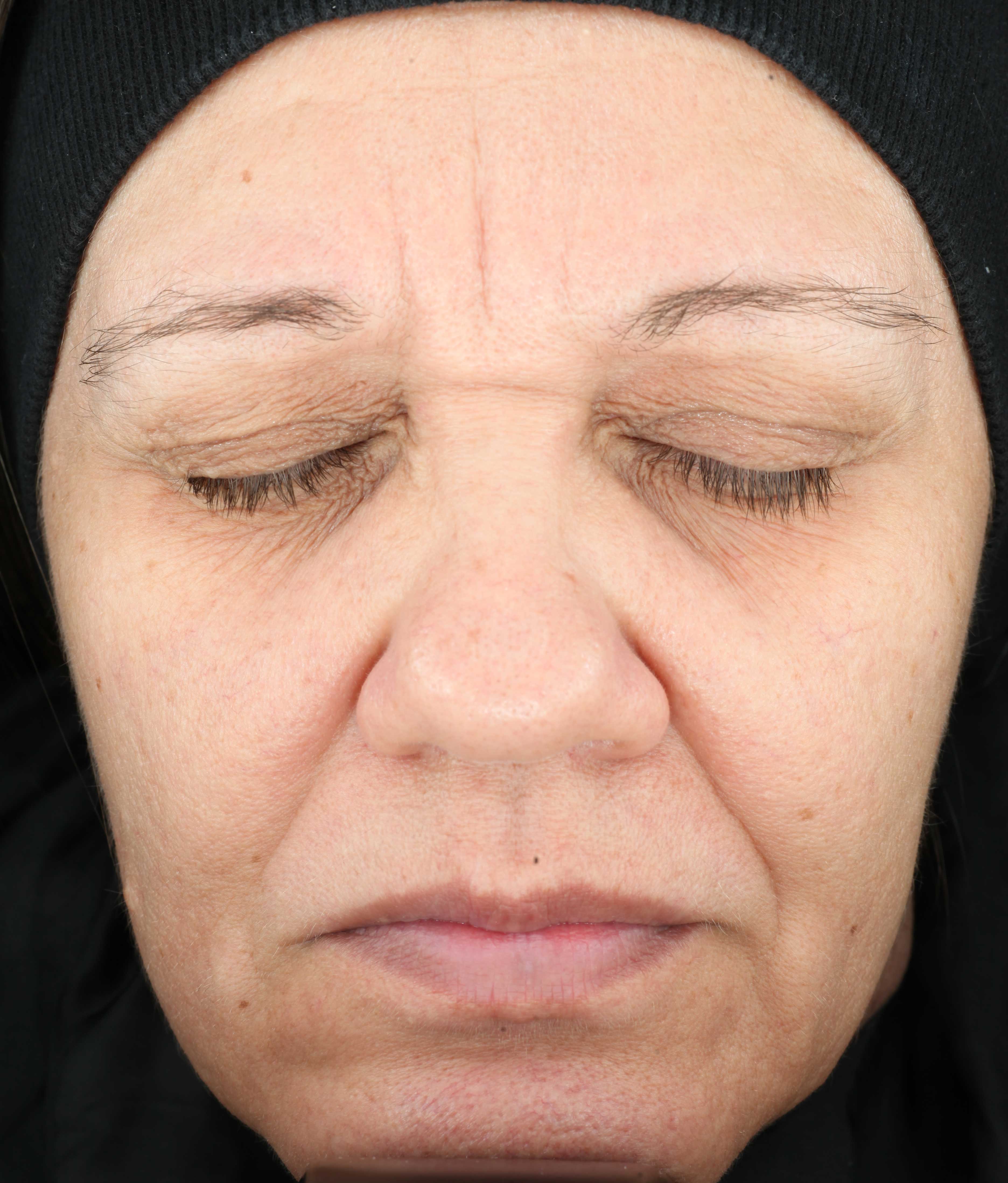 Prije Growth Factor Serum