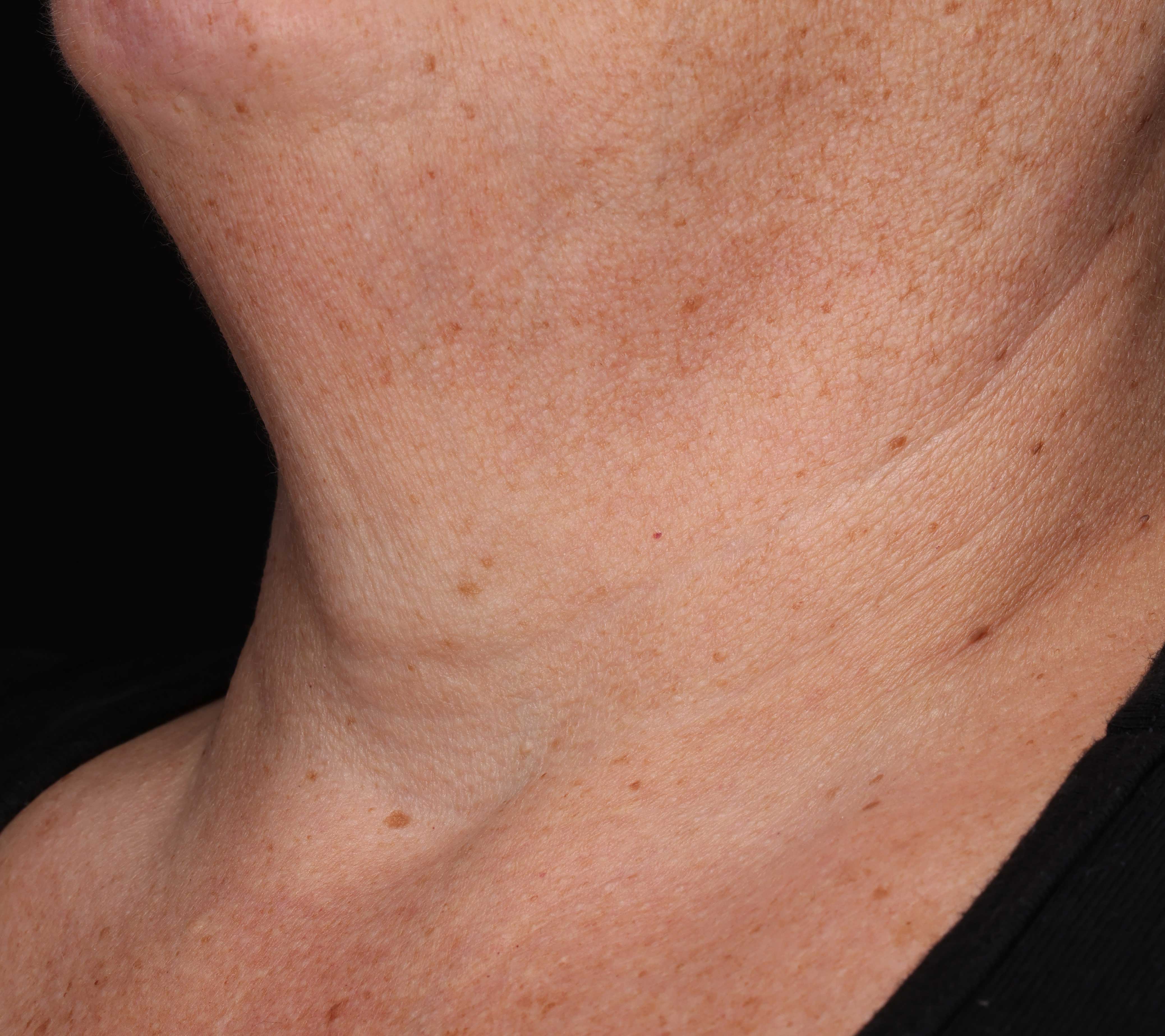 Poslije Neck Complex Anti-Aging + Brightening Serum