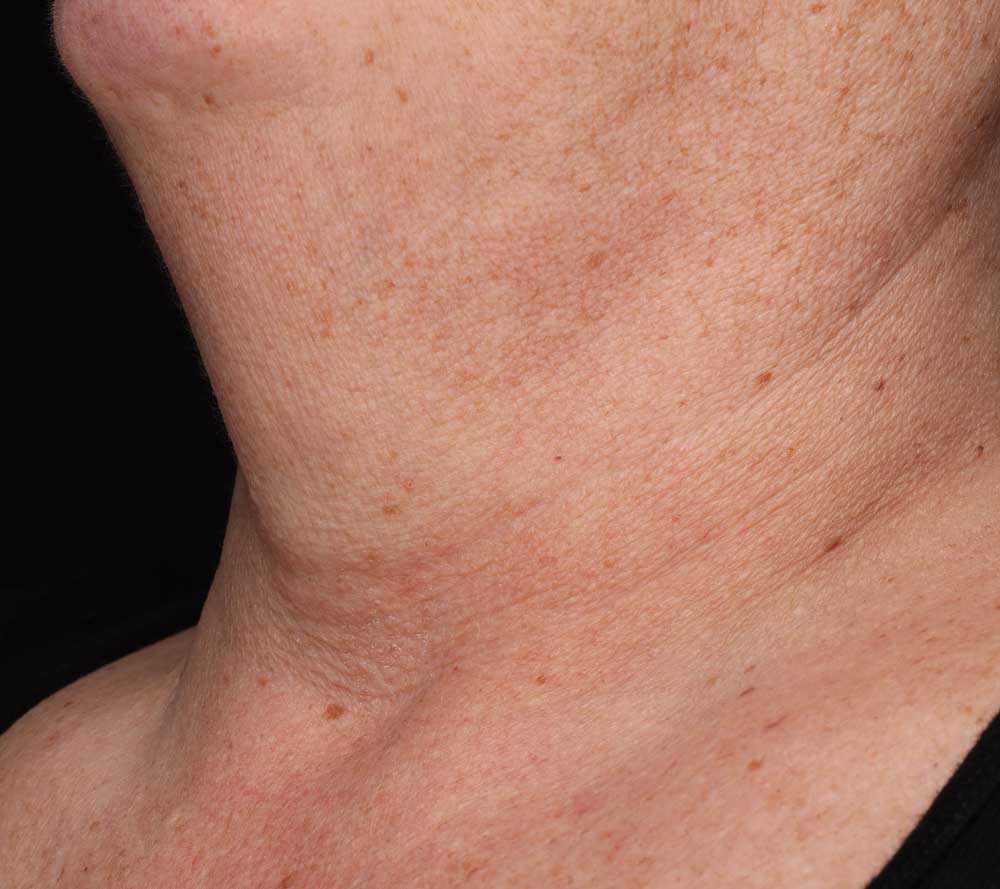 Prije Neck Complex Anti-Aging + Brightening Serum