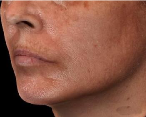 Poslije Peptide Facial Refining Concentrate Poslije Peptide Facial Refining Concentrate