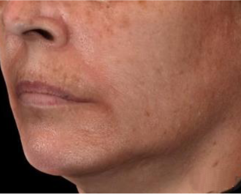 Prije Peptide Facial Refining Concentrate Prije Peptide Facial Refining Concentrate